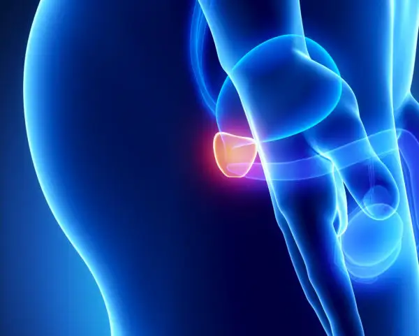 Chronic Non-Bacterial