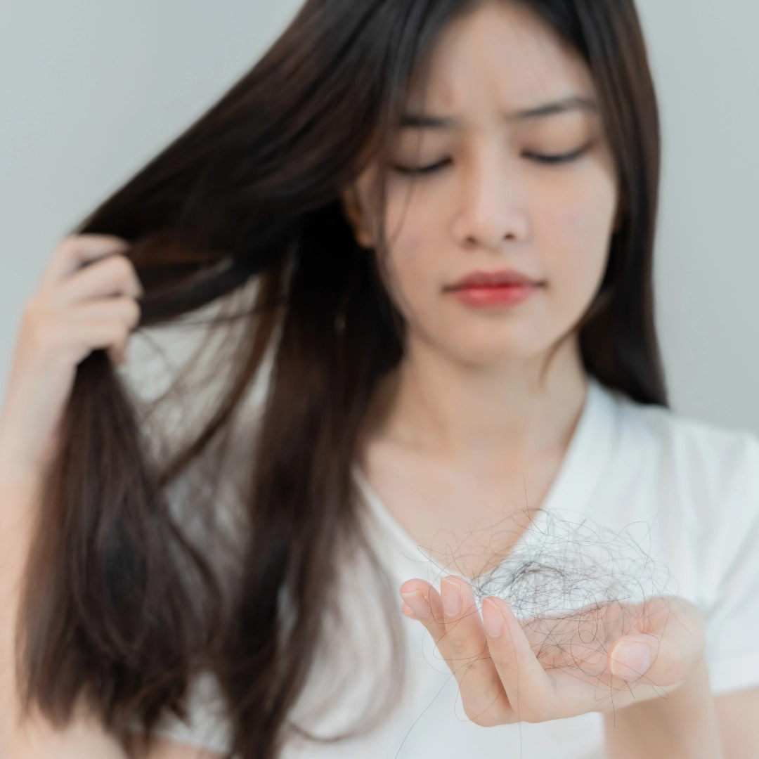 Woman holding hair strands in hand showing hair fall or hair loss concern