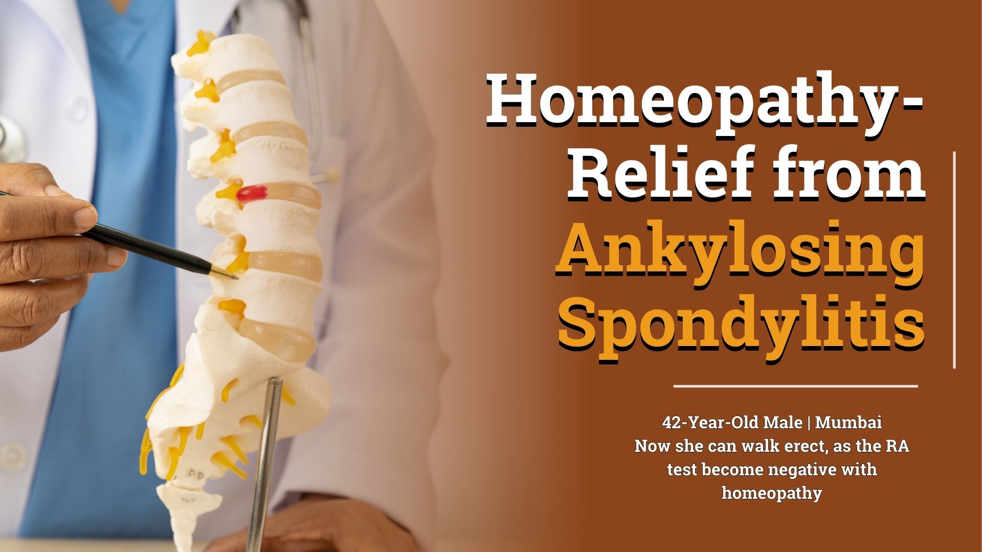 Homeopathy- Relief from Ankylosing Spondylitis 8425