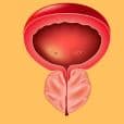 Prostatitis