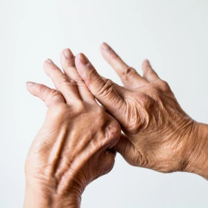 Psoriatic Arthritis