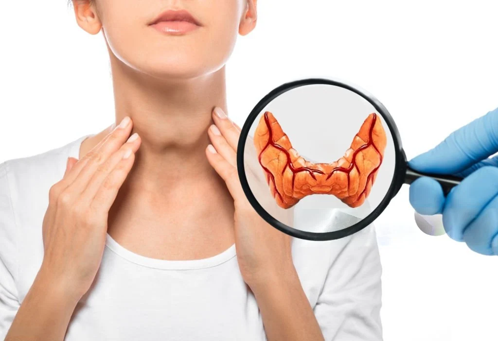 Homeopathic care for underactive thyroid