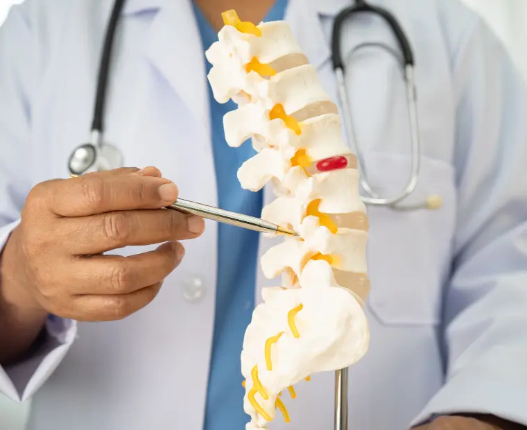 Our-Expertise-in-Cervical-Spondylitis