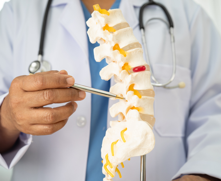 Our Expertise in Cervical Spondylitis