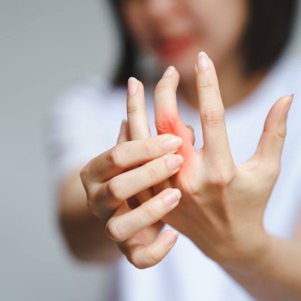 Psoriatic Arthritis
