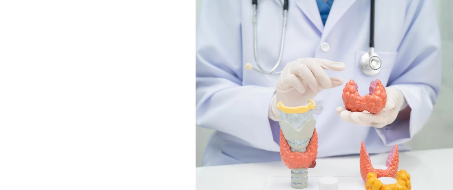 homeopathy for hypothyroidism