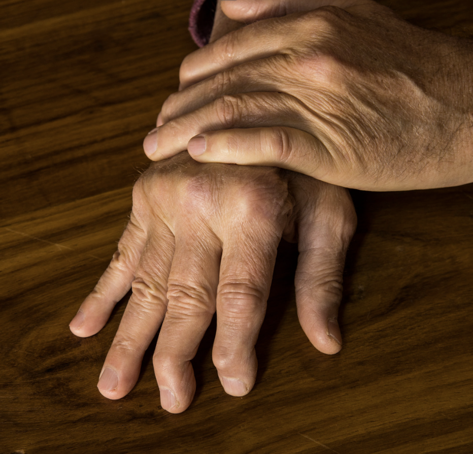 Distal Psoriatic arthritis
