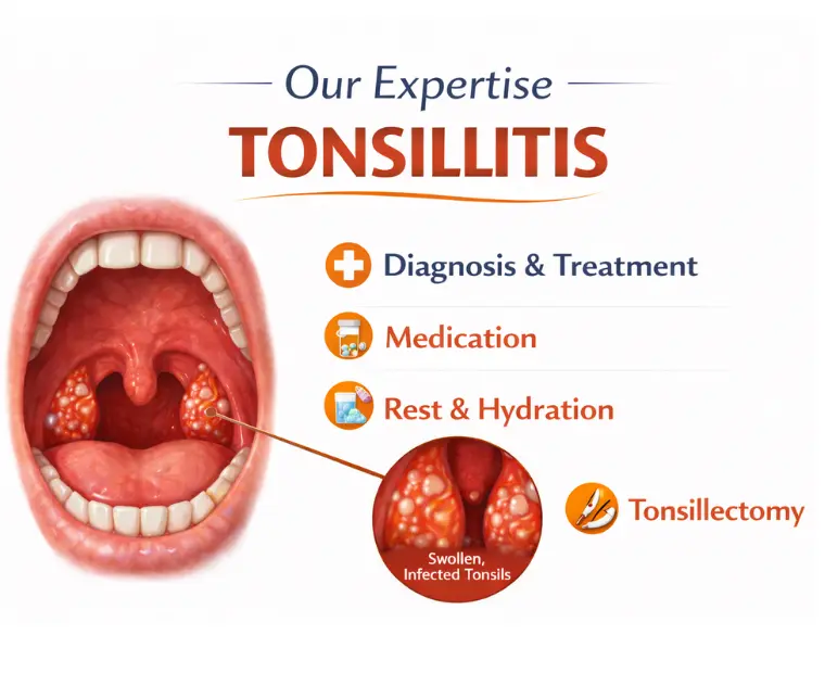 tonsillitis homeopathy treatment