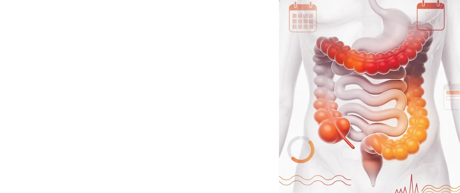 Chronic ulcerative colitis treatment