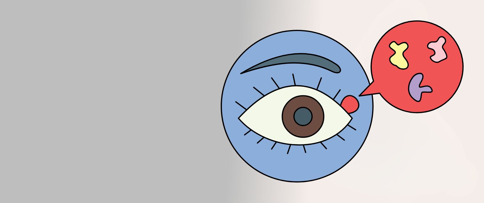 Understanding chalazion