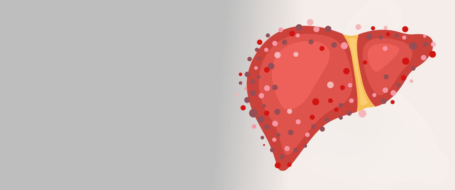 Understanding hepatitis C