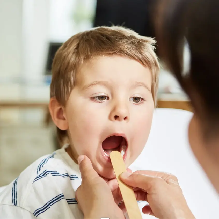 Recurrent Tonsillitis