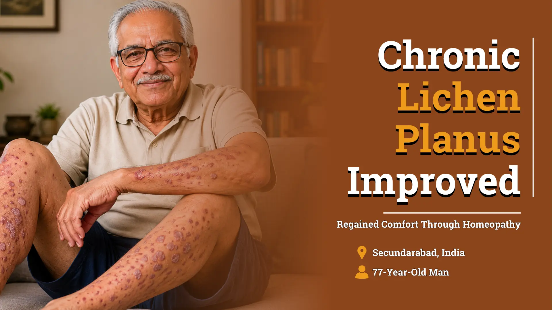 Chronic Lichen Planus Improved with Homeopathic Treatment | Case Study