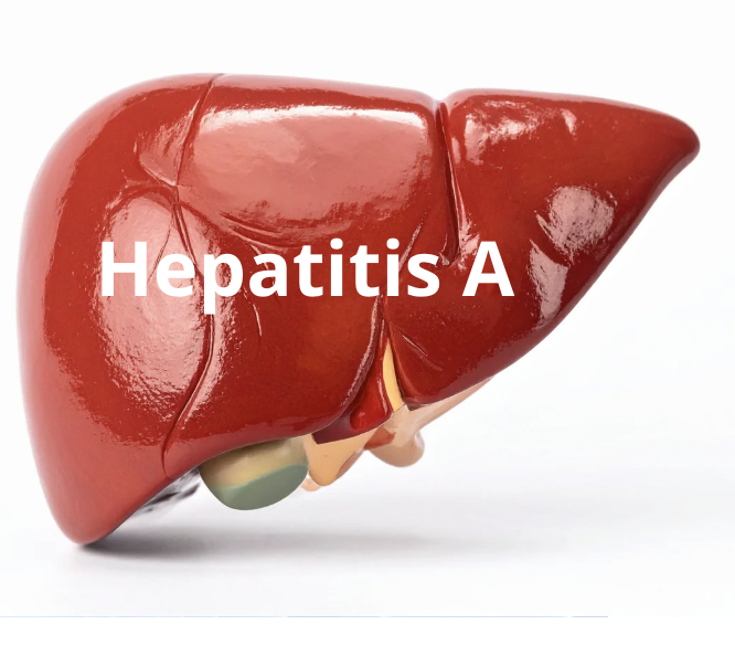 Hepatitis A
