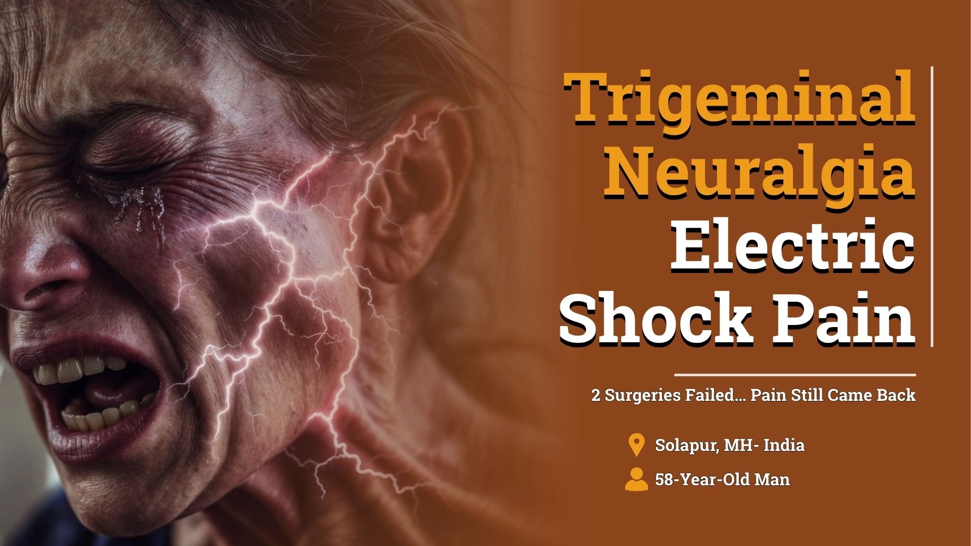 Trigeminal Neuralgia Treatment After Two Failed Surgeries: How a 58-Year-Old Found Lasting Relief Through Homeopathy