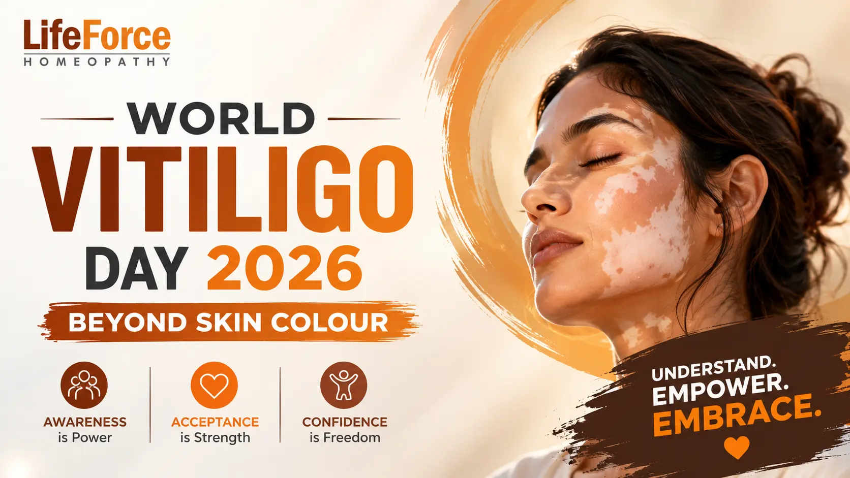 World Vitiligo Day 2026: Understanding Vitiligo Beyond Skin Colour