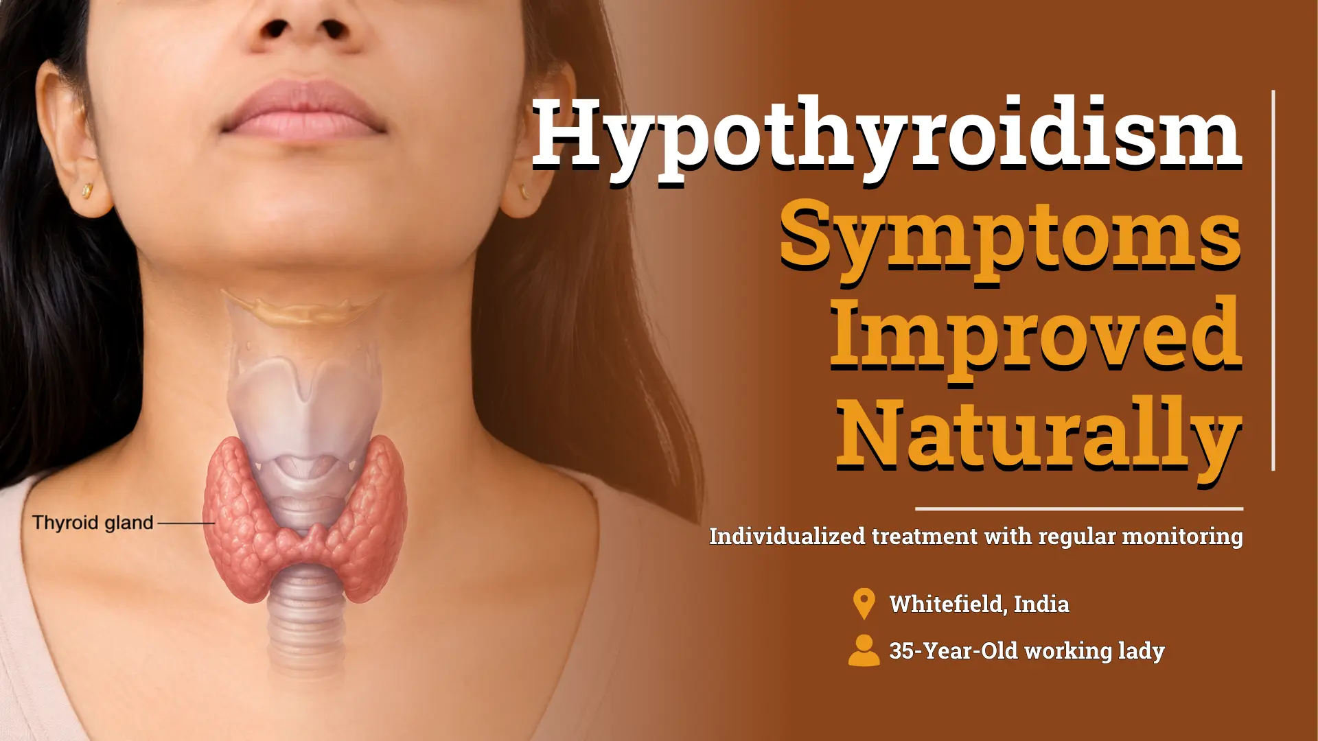 Early-Stage Hypothyroidism Improved With Individualized Homeopathic Treatment