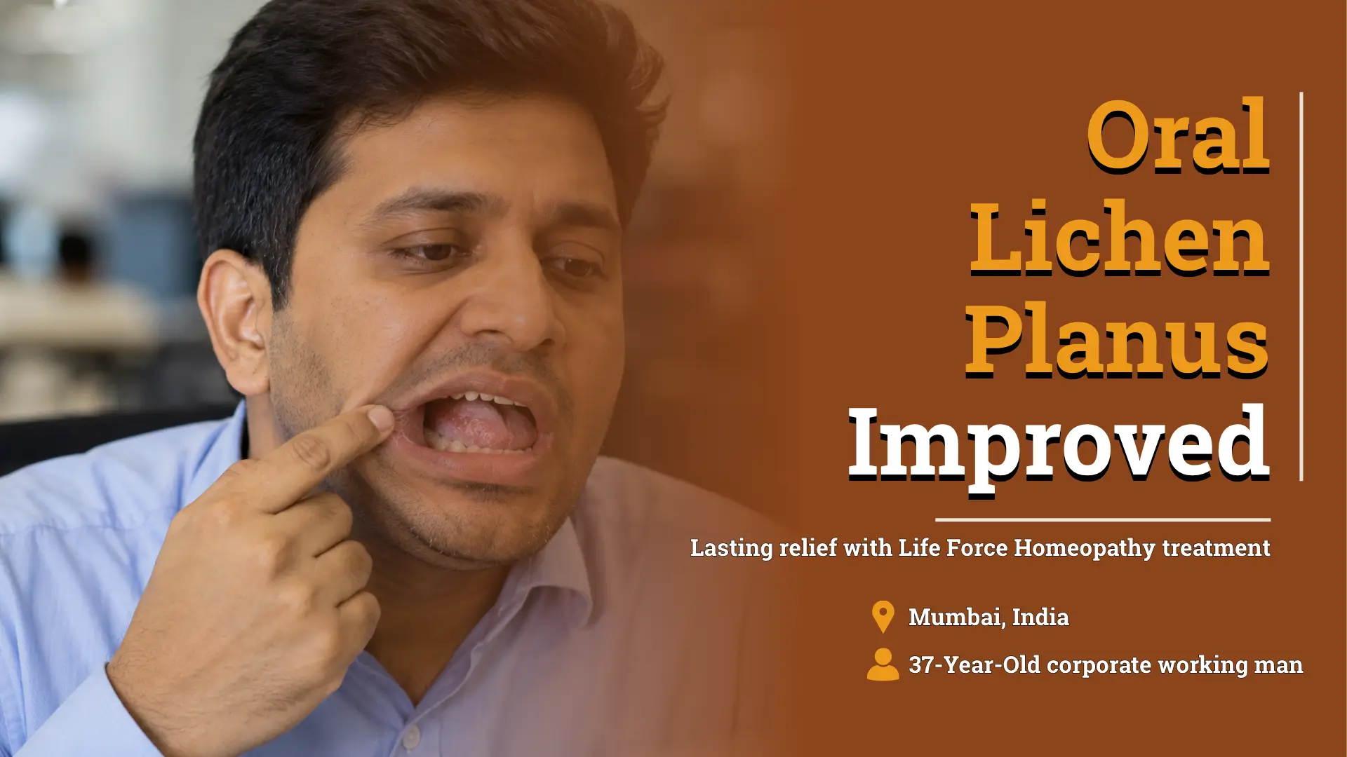 Oral Lichen Planus Improved With Individualized Homeopathic Treatment