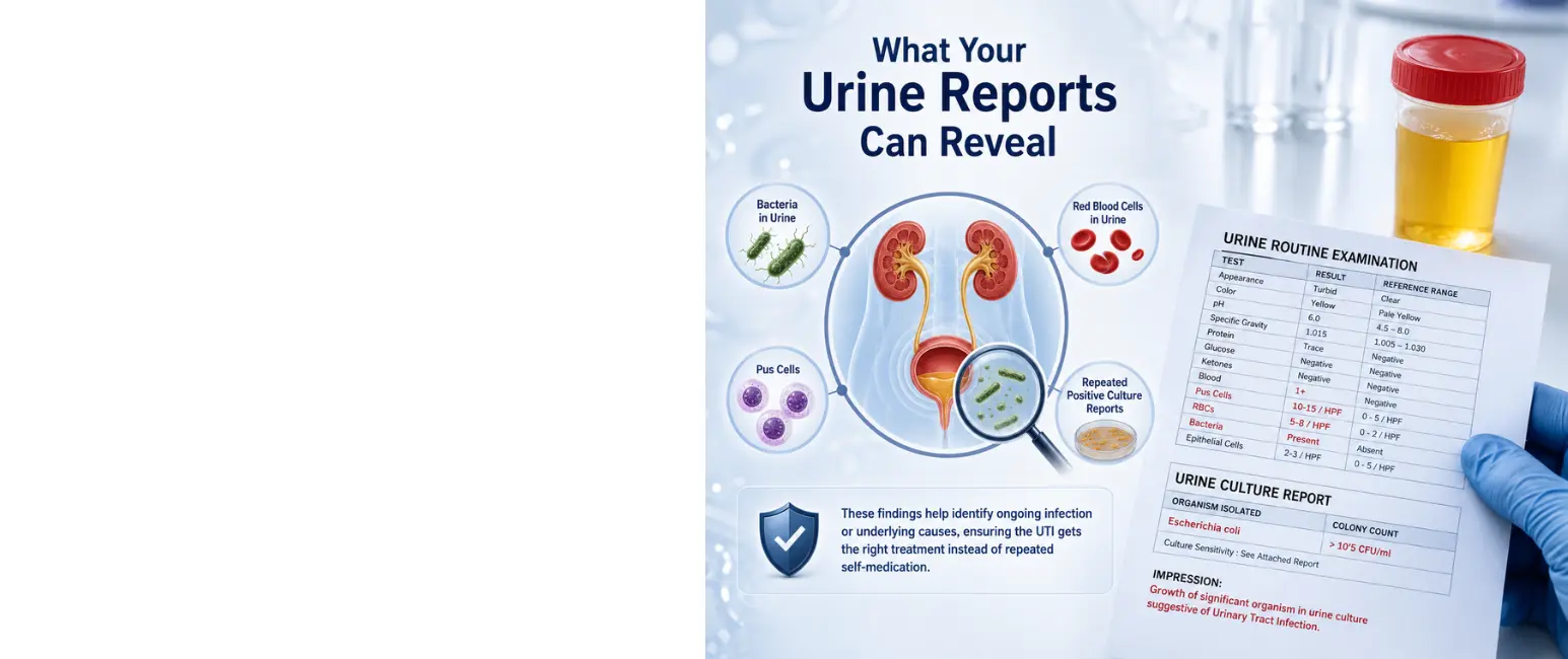 What Your Urine Reports Can Reveal