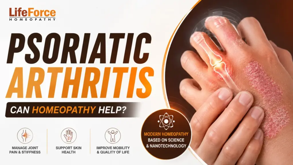 Psoriatic arthritis thumbnail showing swollen painful finger joints with psoriasis skin patches and modern homeopathy approach for managing joint pain and stiffness.