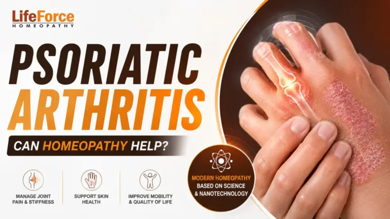 Psoriatic Arthritis: Can Homeopathy Help in Managing Joint Pain and Stiffness?