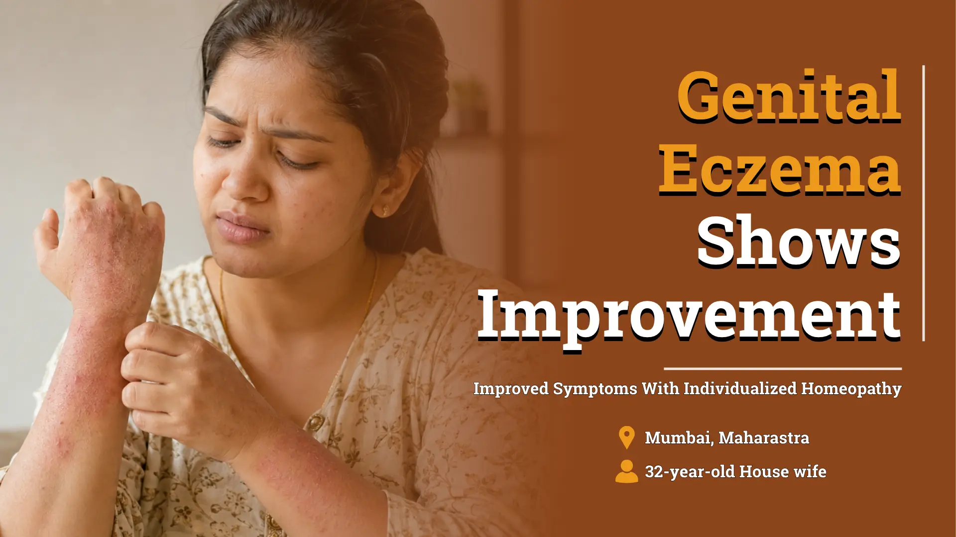Genital Eczema Cleared With Individualized Homeopathic Treatment in Bengaluru