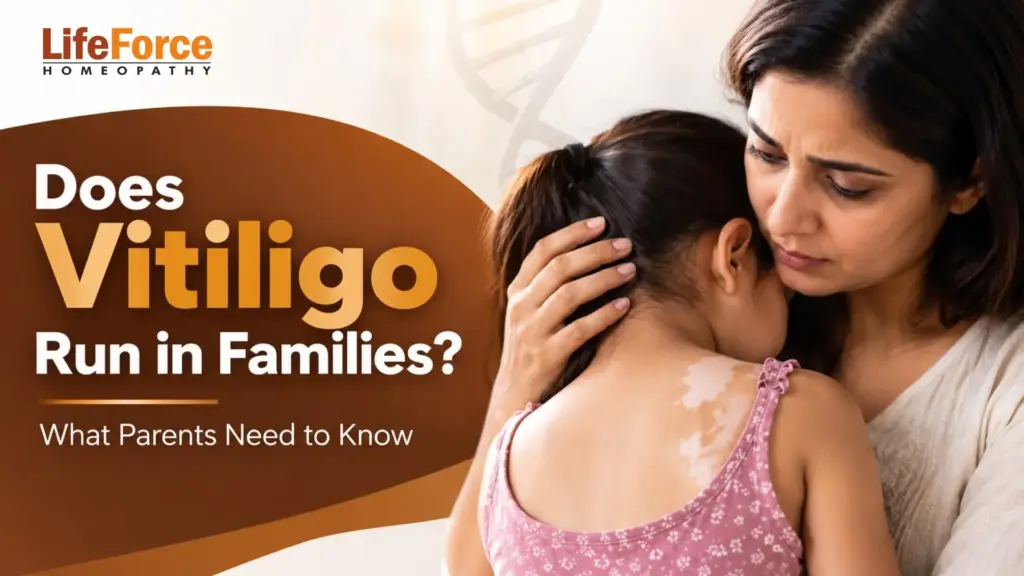Mother comforting a young girl with vitiligo patches on her shoulder, representing hereditary vitiligo concerns in children.