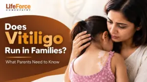 Mother comforting a young girl with vitiligo patches on her shoulder, representing hereditary vitiligo concerns in children.