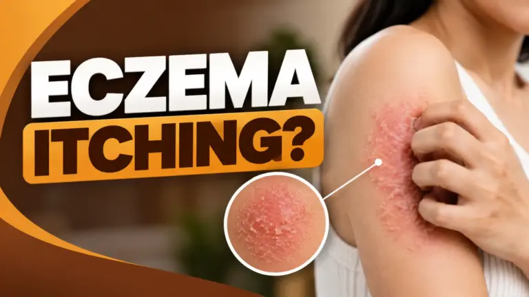 How to Stop Eczema Itching Quickly: 7 Doctor-Recommended At-Home Tips