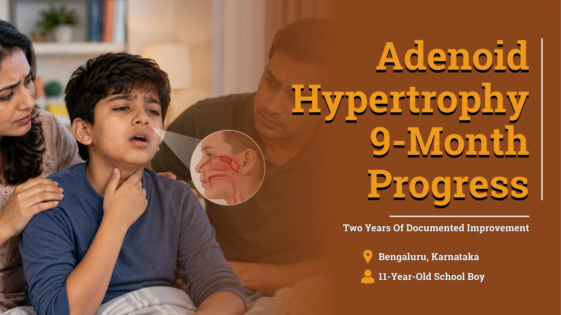 Adenoid Hypertrophy Treatment: A 9-Month Case Study of an 11-Year-Old Boy