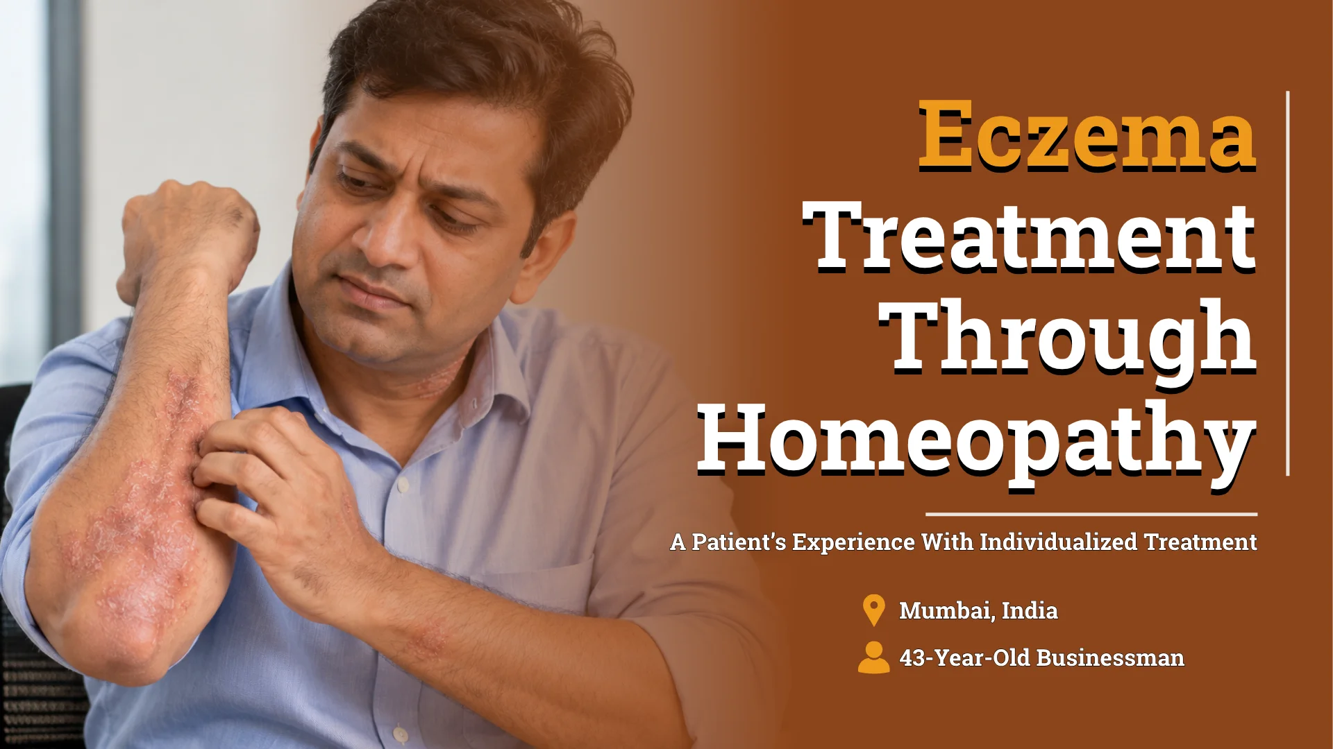 Eczema Treatment: A 13-Month Case Study of Eyelid and Neck Eczema in a 43-Year-Old Man